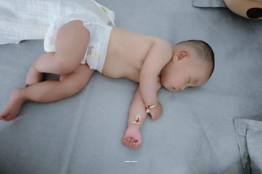 孟州宝宝头上长痱子